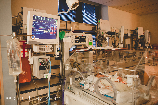 World Prematurity Day | Photographing NICU Babies photo