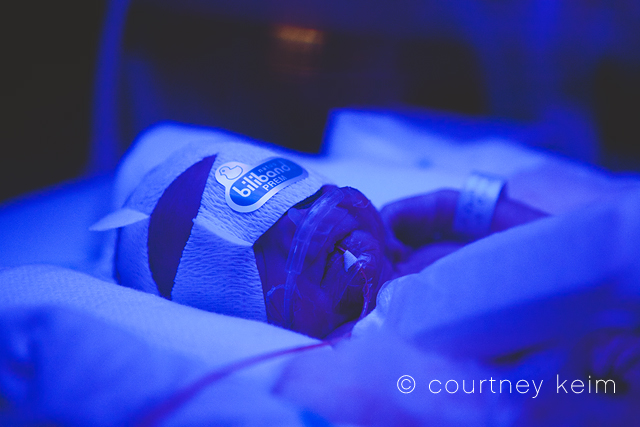 World Prematurity Day | Photographing NICU Babies photo