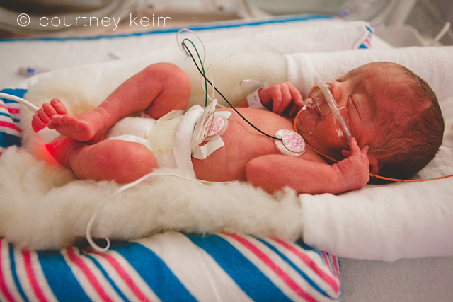 World Prematurity Day | Photographing NICU Babies photo