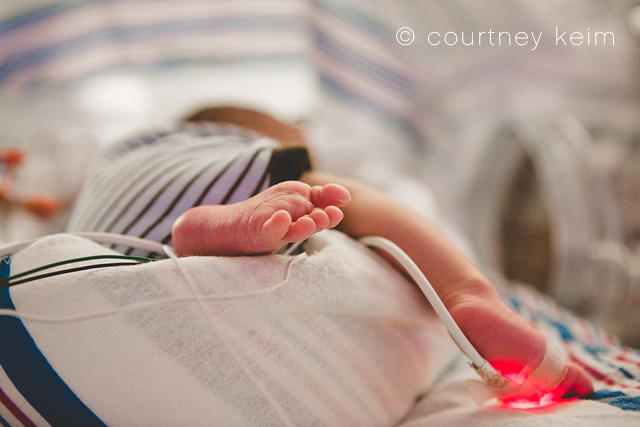 World Prematurity Day | Photographing NICU Babies photo